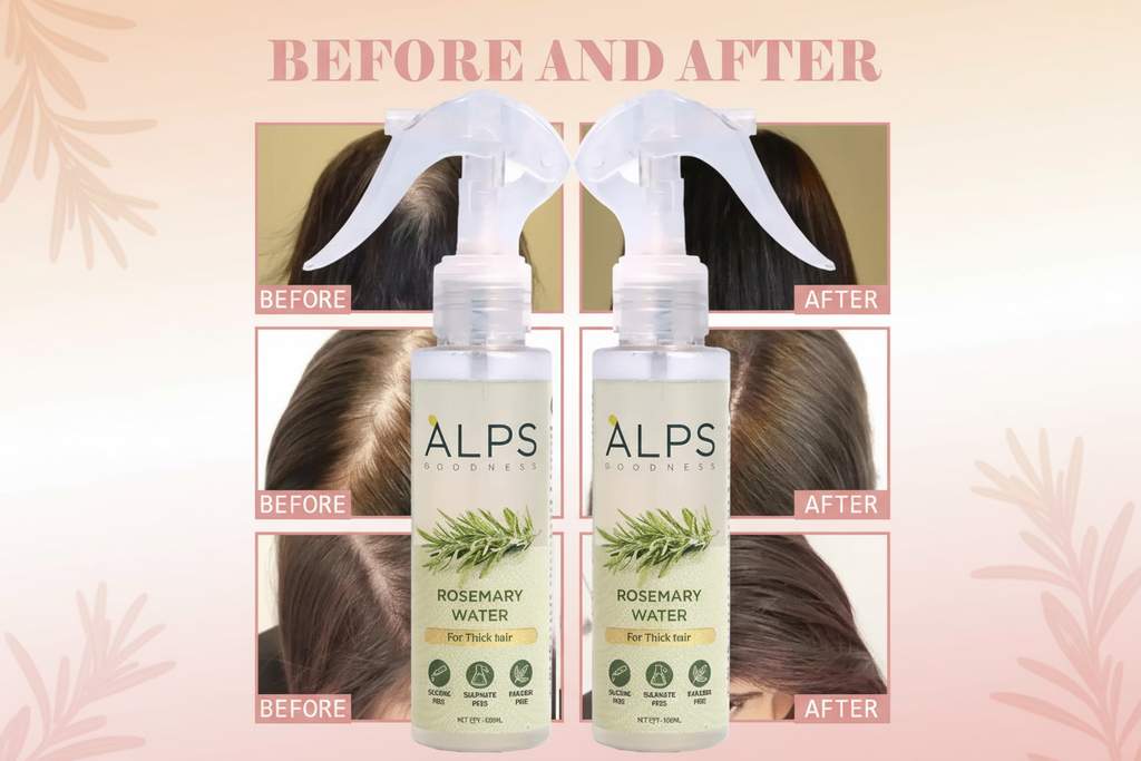 Rosemary Water Hair Spray ( Buy 1 Get 2 Free )
